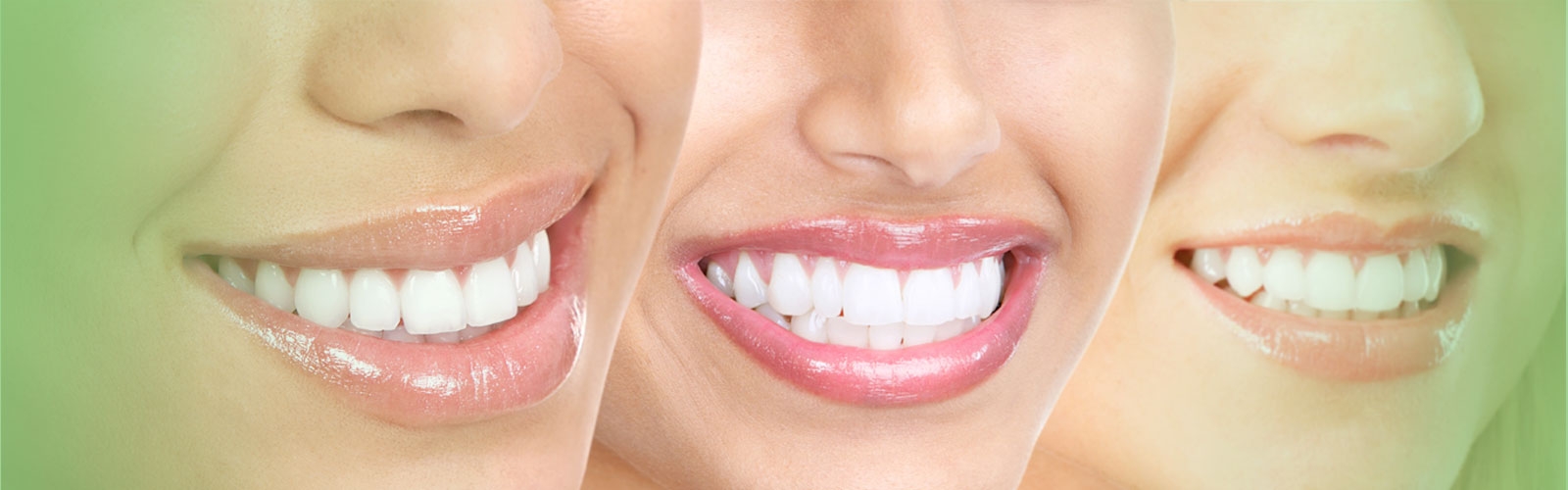 New Smile.. New You